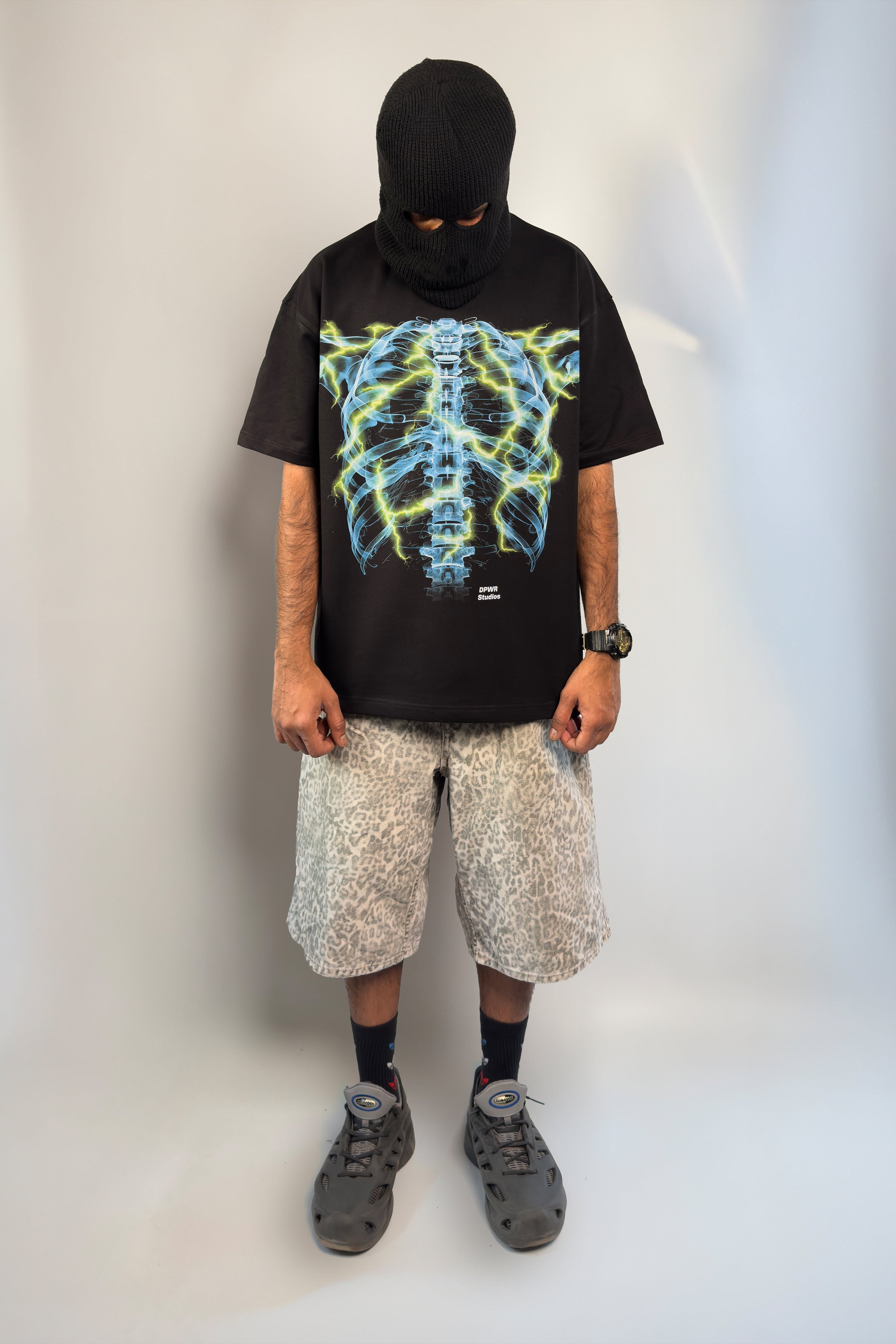 X-Ray