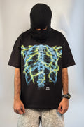 X-Ray