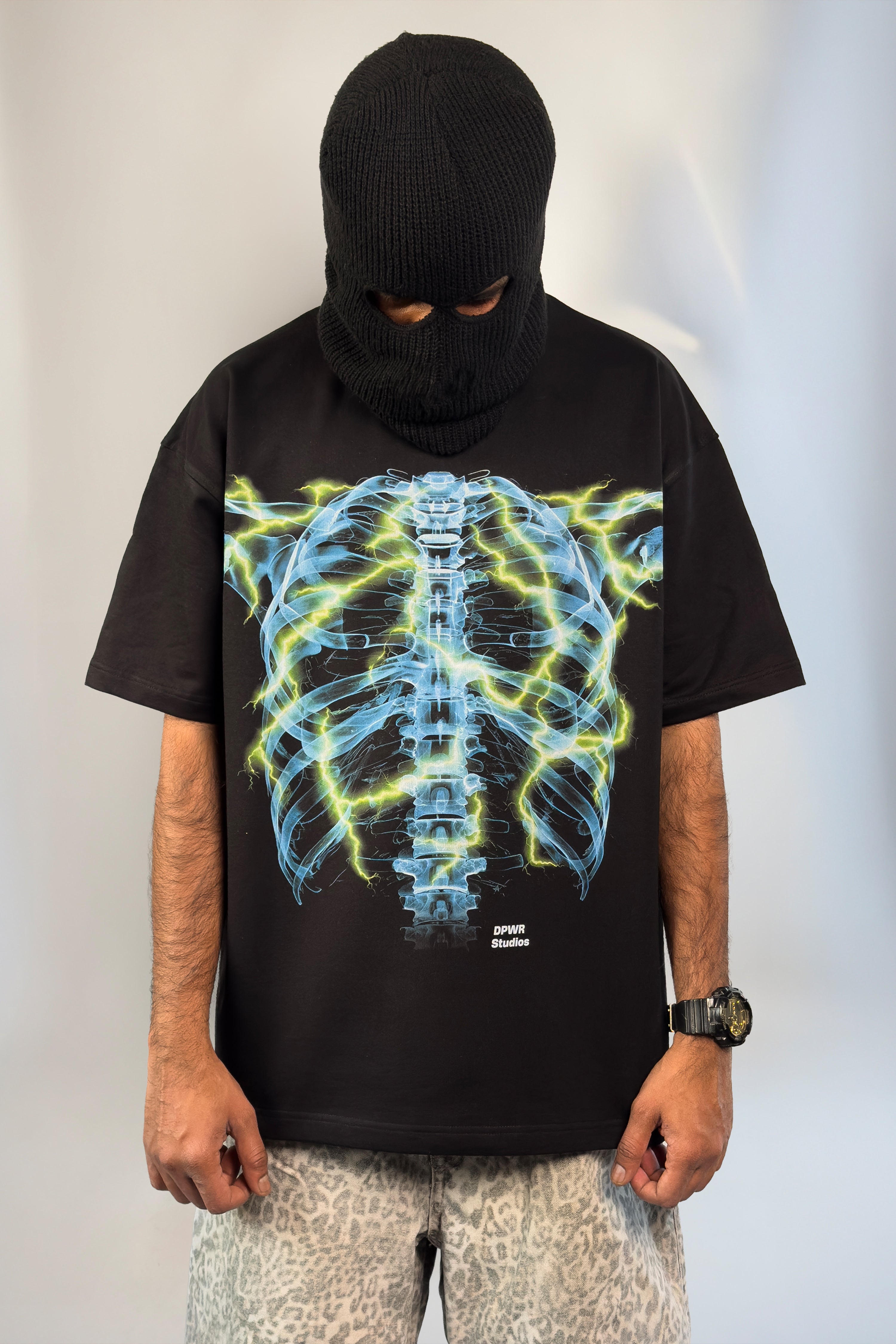 X-Ray