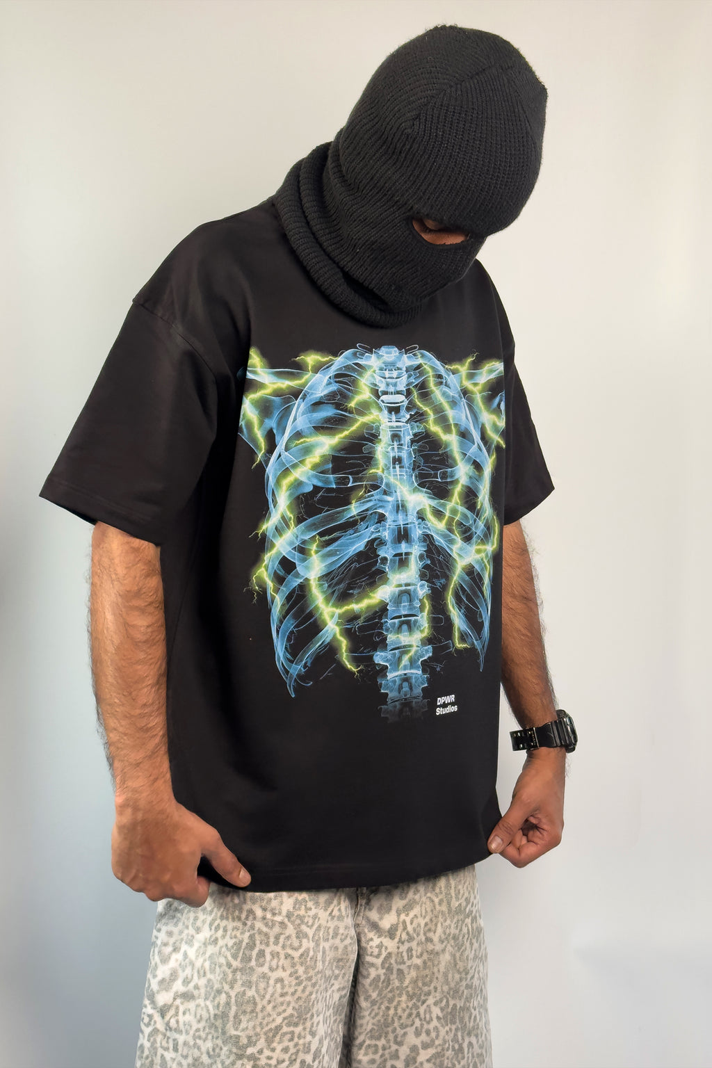 X-Ray