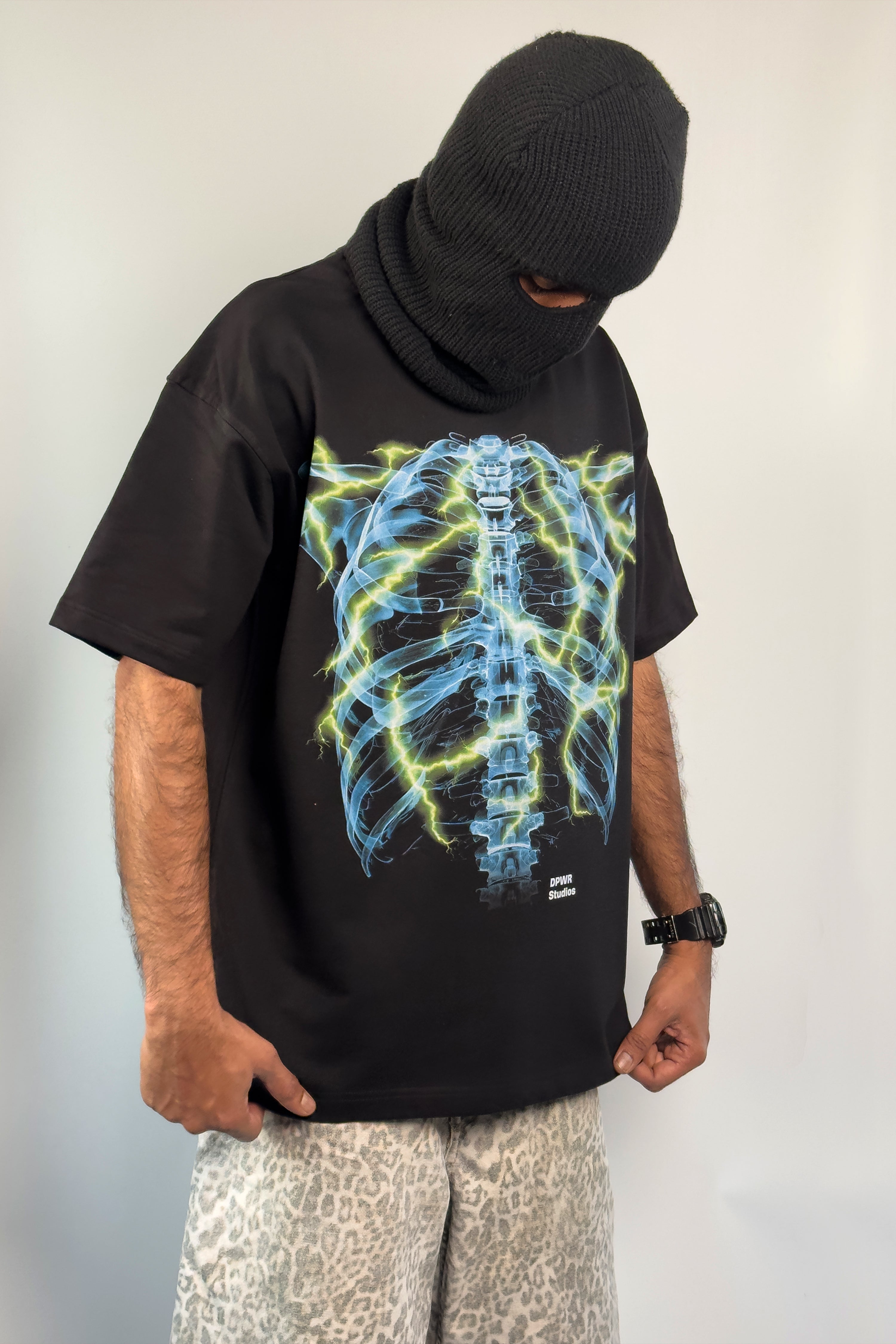 X-Ray
