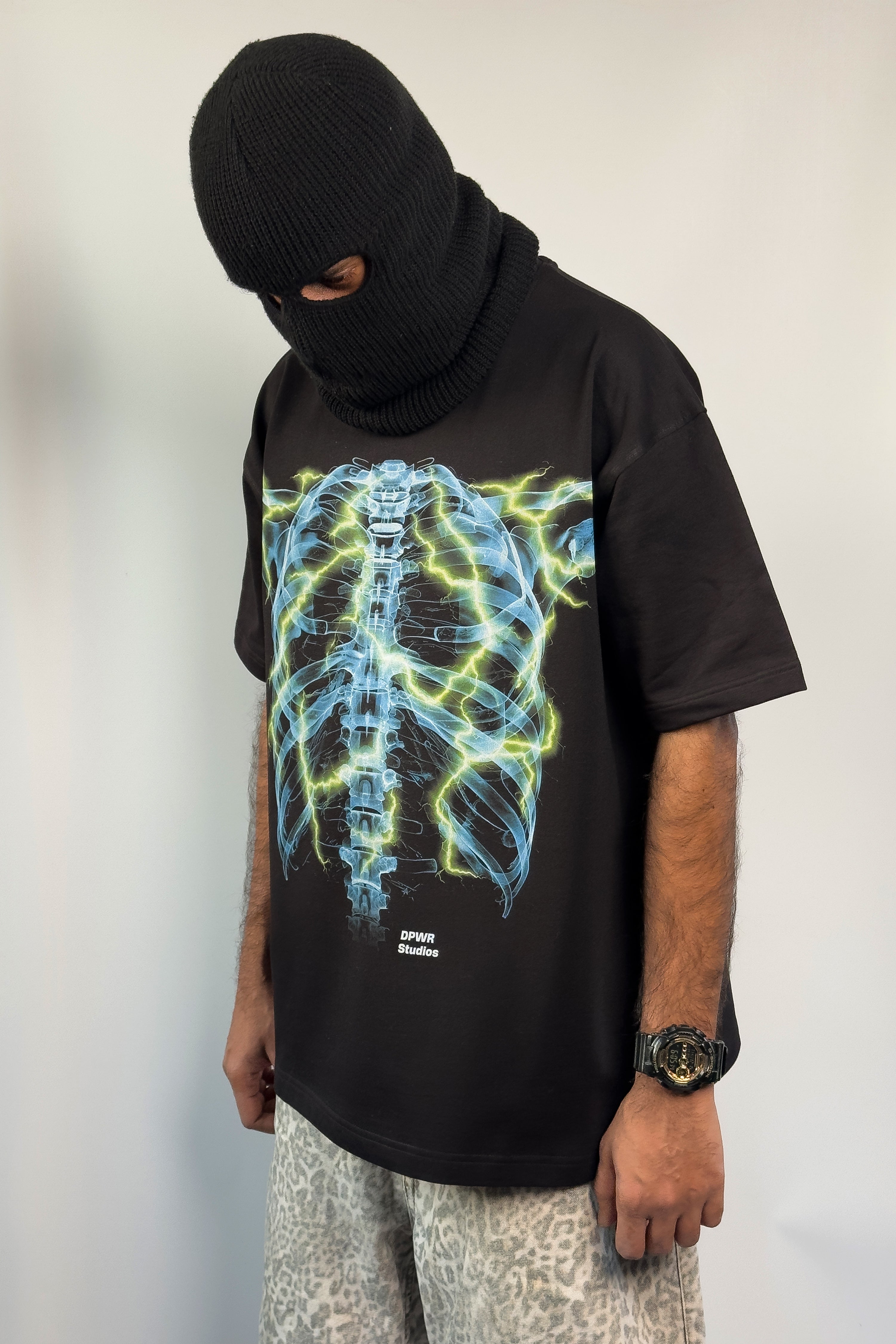 X-Ray