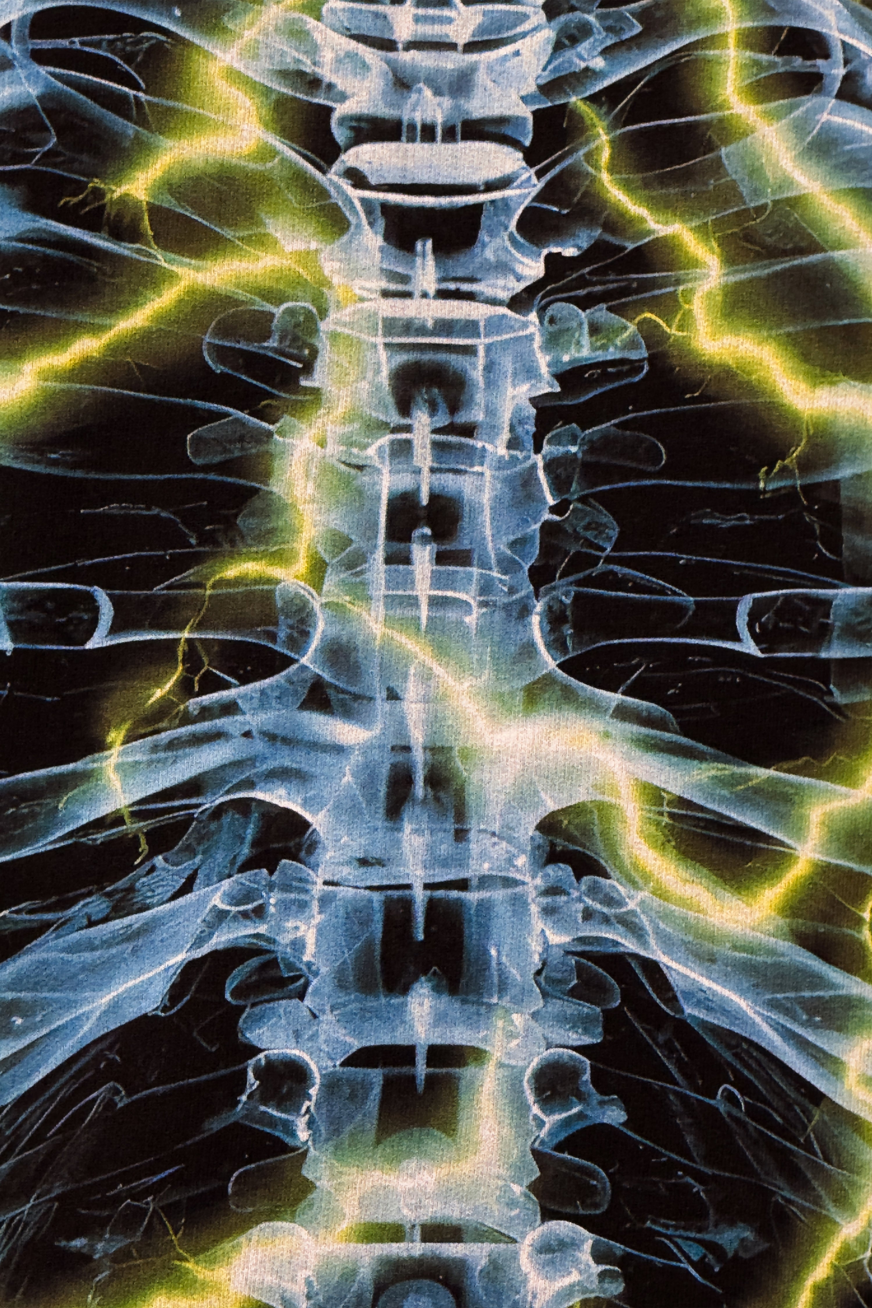 X-Ray